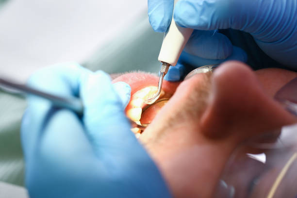 Emergency Dentist Open Today in AL